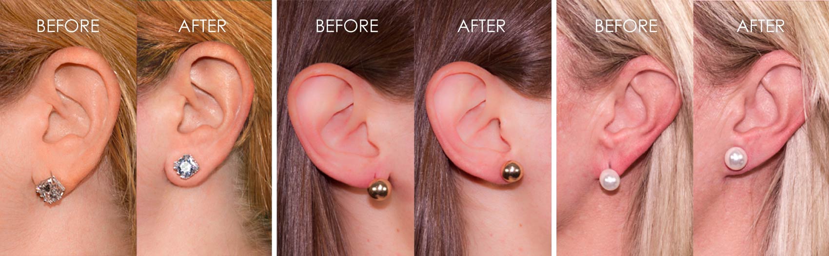 BetterBax - Instant Lift Earring Backs That Keep Your Earrings